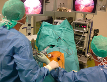 chirurgie-de-obesite